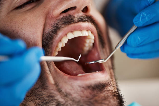 Best Emergency Treatment for Toothache in Greenbelt, MD
